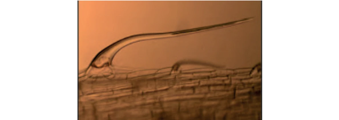 PČR: Obr. 3 – Stonkový přirostlý trichom (11)