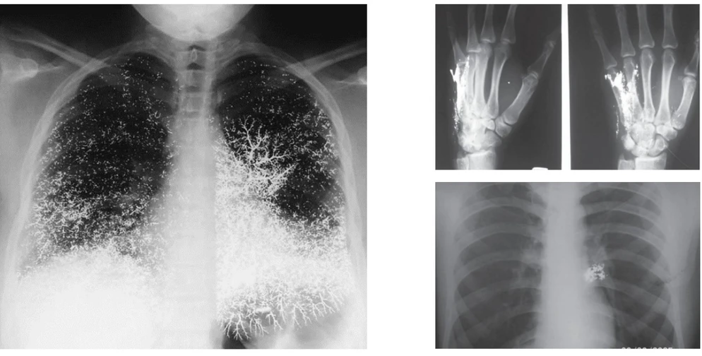 AV ČR: Toxikologie rtuti