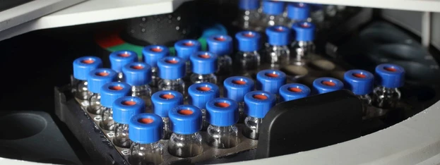 Představujeme BIOCEV OMICS Servisní oddělení hmotnostní spektrometrie