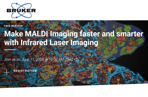 Make MALDI Imaging faster and smarter with Infrared Laser Imaging