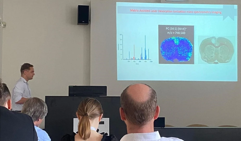 ČSHS: Internal standard normalization in MALDI mass spectrometry imaging (Hynek Mácha)