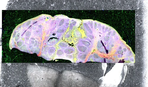 FTIR a Ramanova mikroskopie: Pokročilé možnosti akvizice a interpretace dat