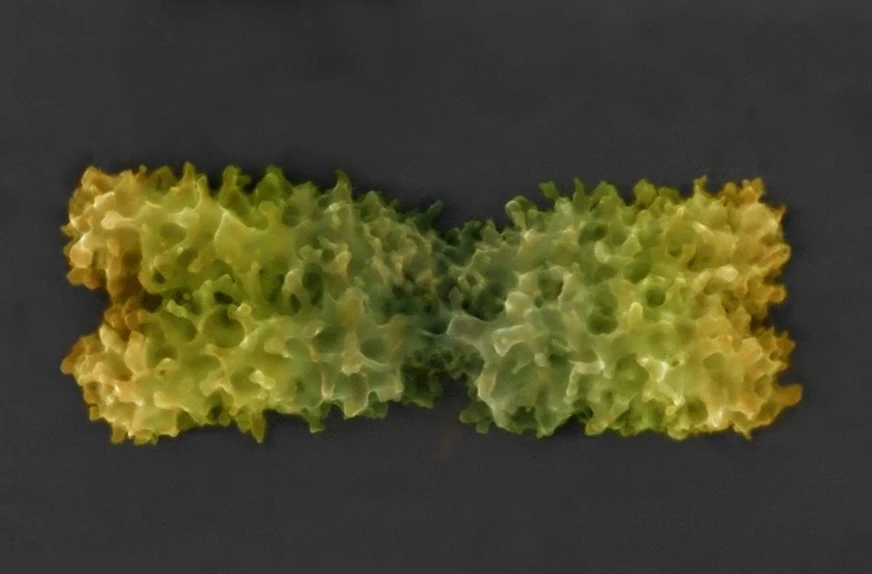 Vědavýzkum.cz / ÚPT AV ČR: kolorovaný snímek chromozomu v nativním stavu získaný pomocí nově vyvinuté pokročilé environmentální rastrovací elektronové mikroskopie.